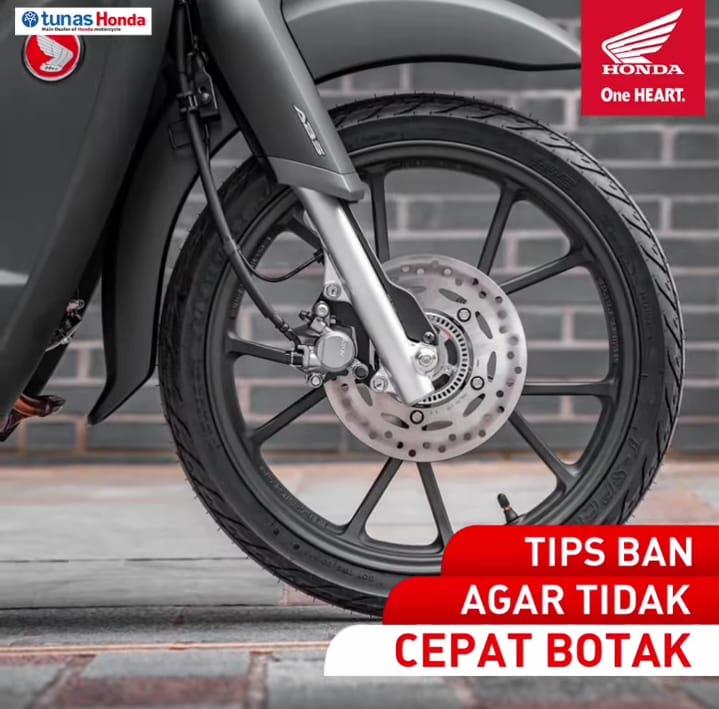 Tips Ban Agar Tidak Cepat Botak Dari NSS Kedaton