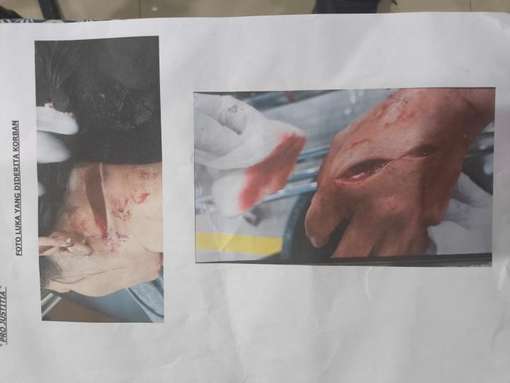 Tega Bacok Kekasih Sendiri, Pemuda di Bandar Lampung Terancam 9 Tahun Penjara