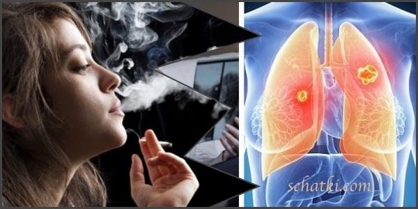 Inilah 7 Bahaya Merokok Bagi Perempuan