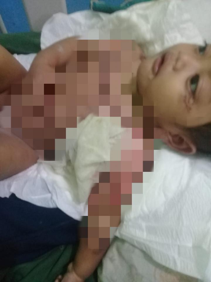 Bayi 10 Bulan Korban Luka Bakar Butuh Uluran Tangan Para Dermawan