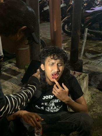 Aksi Aliansi Suara Rakyat (ASURO) 