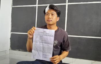 Diduga Dianiaya Anak Purnawirawan Polri, Pegawai Bank Alami Luka Empat Jahitan di Kepala