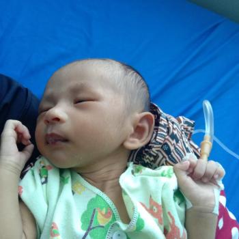 Bayi Mungil  1 Bulan Butuh Uluran Tangan Dermawan