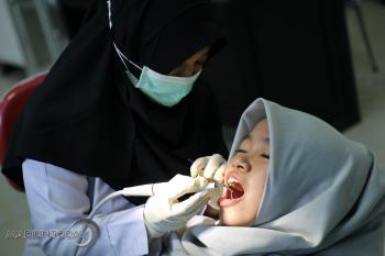 Penyebab dan Tips Ampuh Membersihkan Karang Gigi 